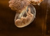 Cele mai interesante lucruri despre lichidul amniotic